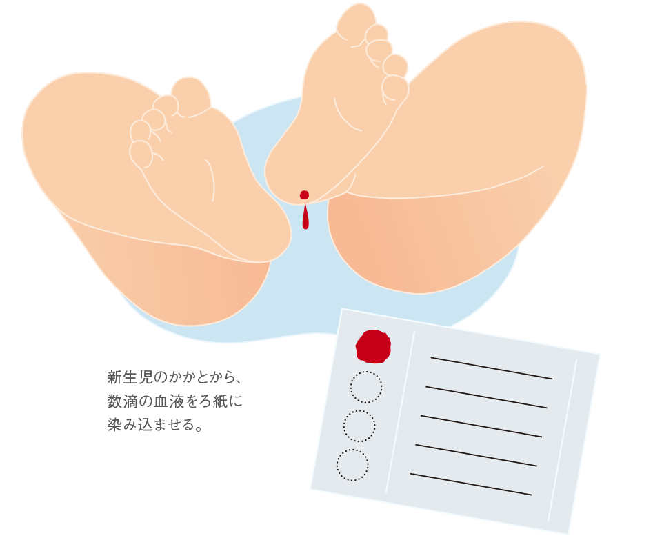 タンデム マス スクリーニング