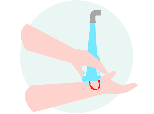 石鹸と流水で傷口を洗うイメージ画像